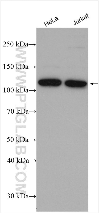 RNF20 Antibody in Western Blot (WB)