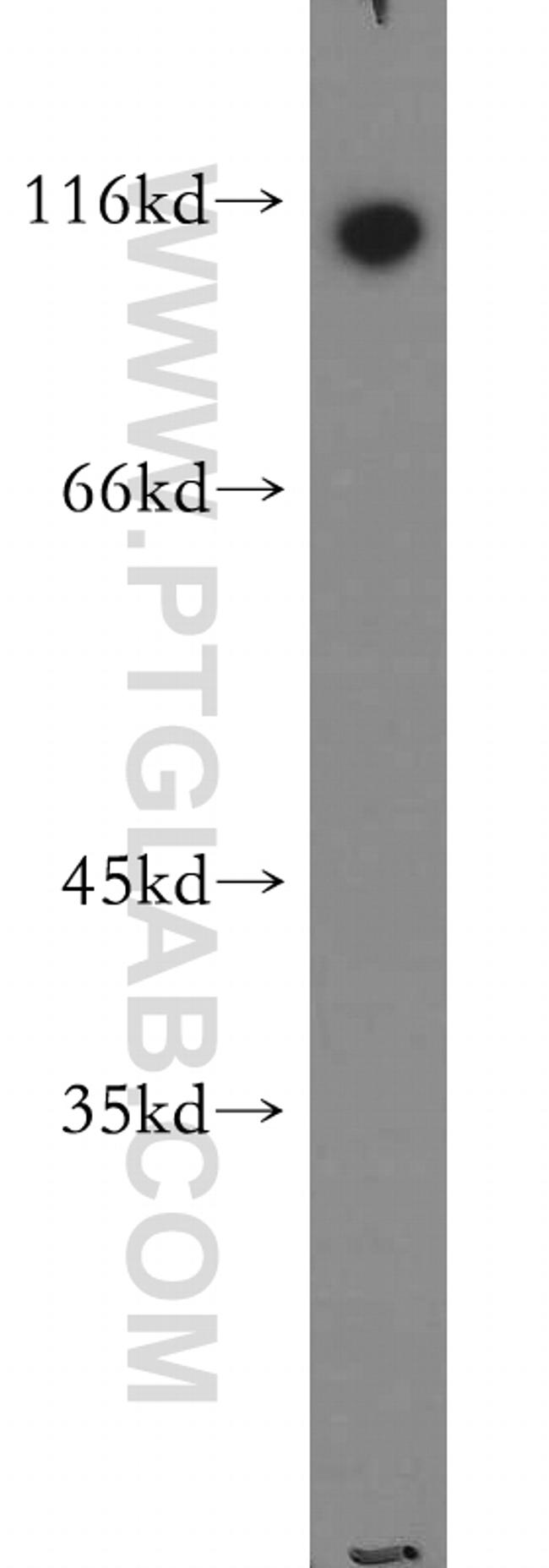 RNF20 Antibody in Western Blot (WB)