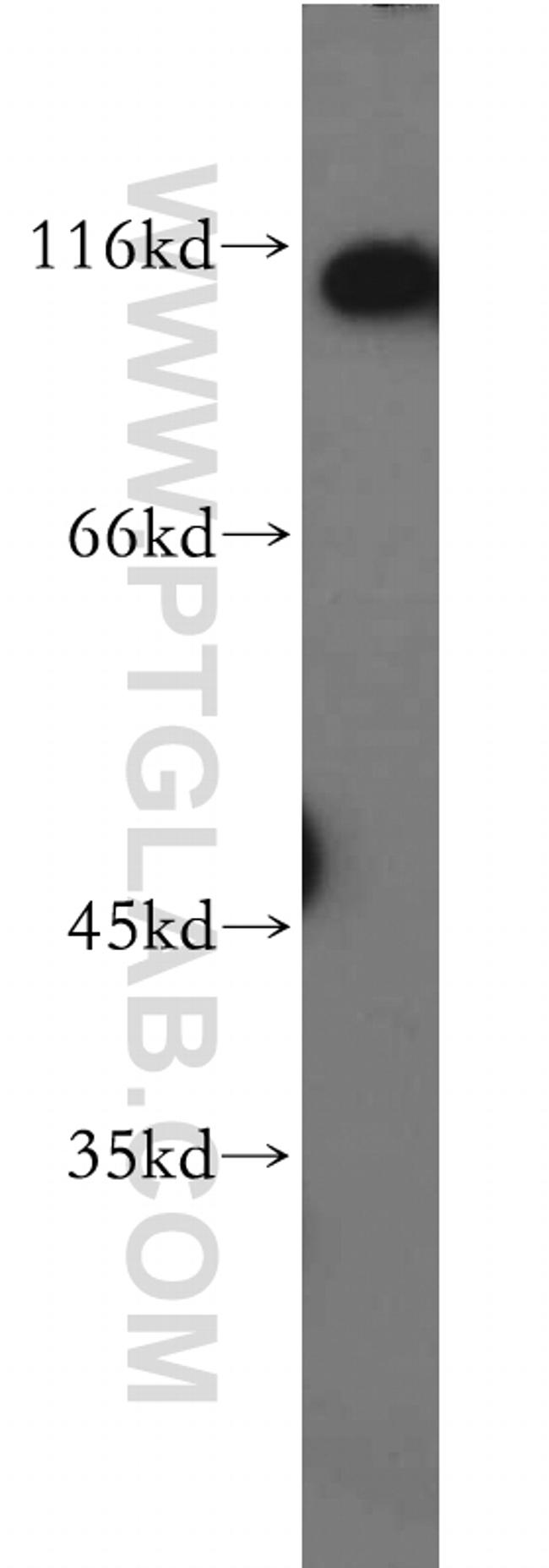 RNF20 Antibody in Western Blot (WB)