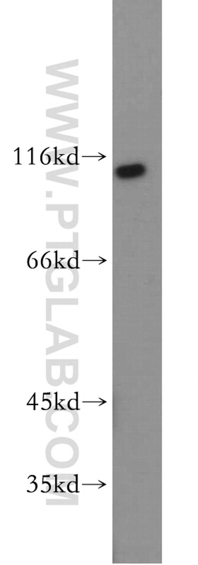 RNF20 Antibody in Western Blot (WB)