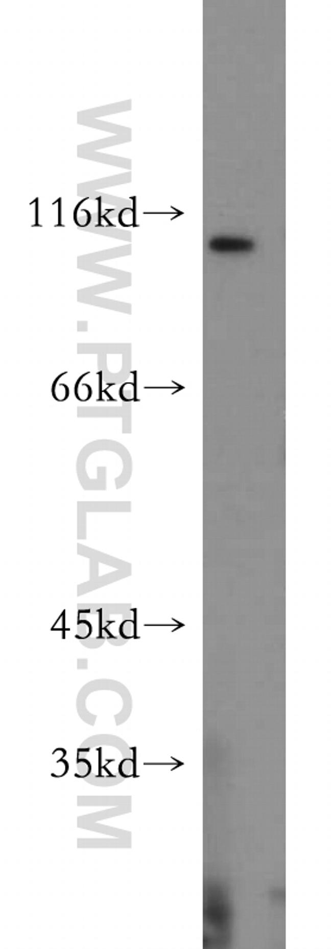 RNF20 Antibody in Western Blot (WB)