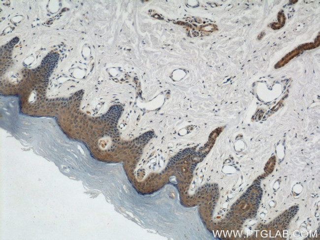 KIF5B Antibody in Immunohistochemistry (Paraffin) (IHC (P))