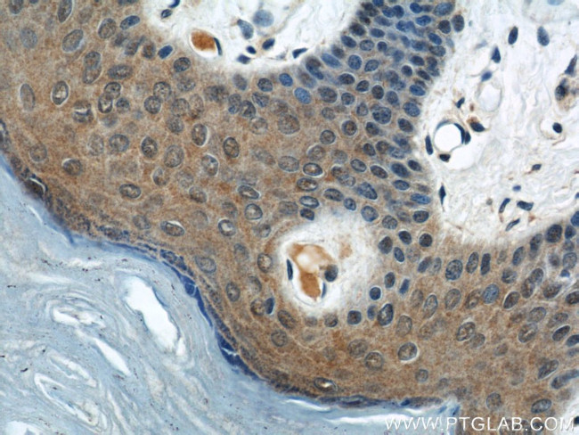 KIF5B Antibody in Immunohistochemistry (Paraffin) (IHC (P))