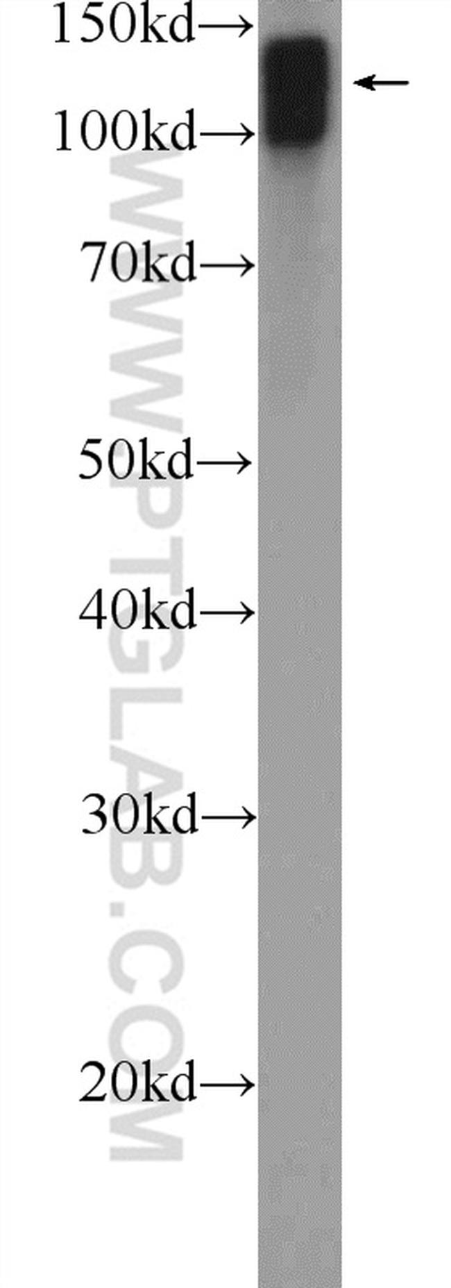 KIF5B Antibody in Western Blot (WB)