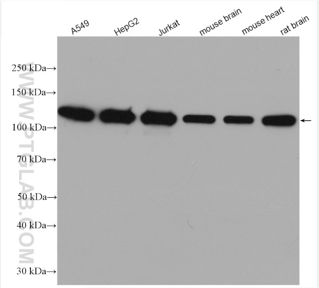 KIF5B Antibody in Western Blot (WB)