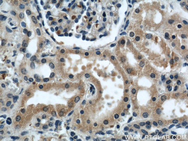 KIF5B Antibody in Immunohistochemistry (Paraffin) (IHC (P))