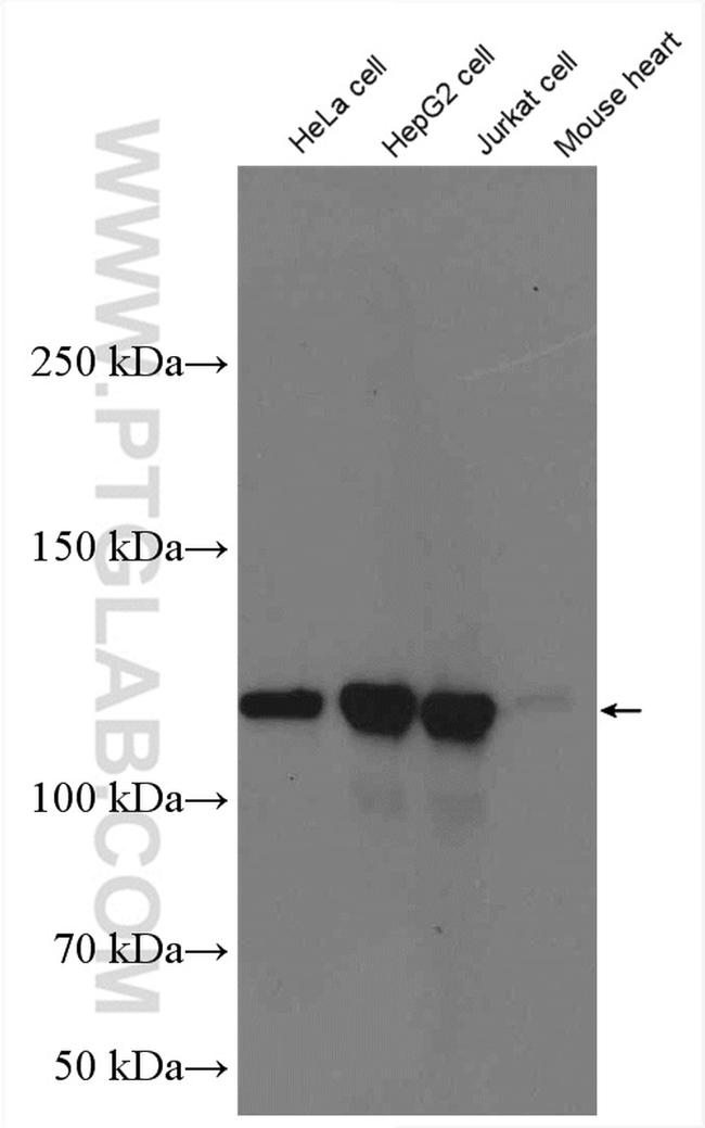 KIF5B Antibody in Western Blot (WB)