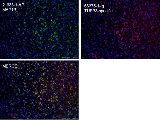 MAP1B Antibody in Immunohistochemistry (PFA fixed) (IHC (PFA))