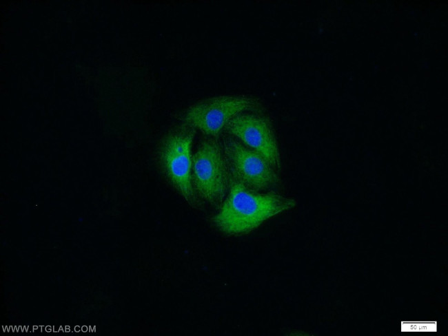 MAP1B Antibody in Immunocytochemistry (ICC/IF)