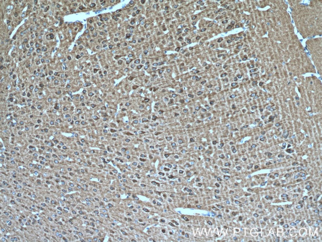 MAP1B Antibody in Immunohistochemistry (Paraffin) (IHC (P))