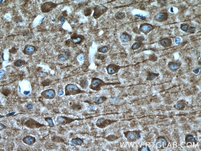 MAP1B Antibody in Immunohistochemistry (Paraffin) (IHC (P))