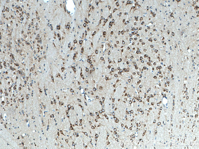 MAP1B Antibody in Immunohistochemistry (Paraffin) (IHC (P))