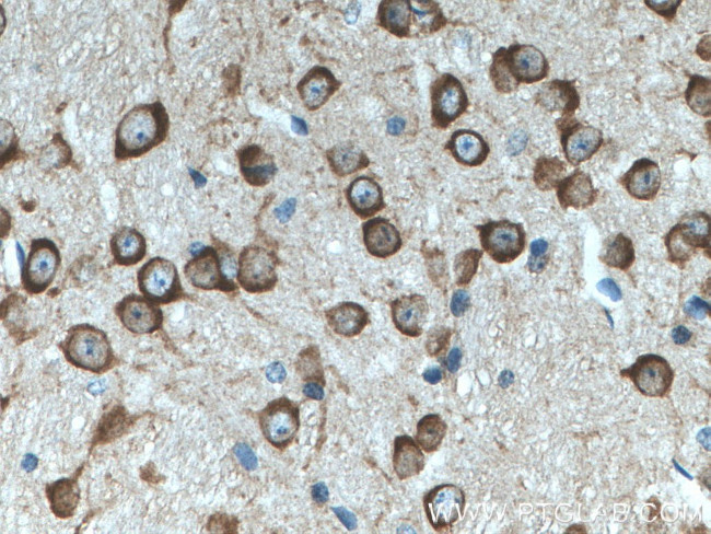 MAP1B Antibody in Immunohistochemistry (Paraffin) (IHC (P))