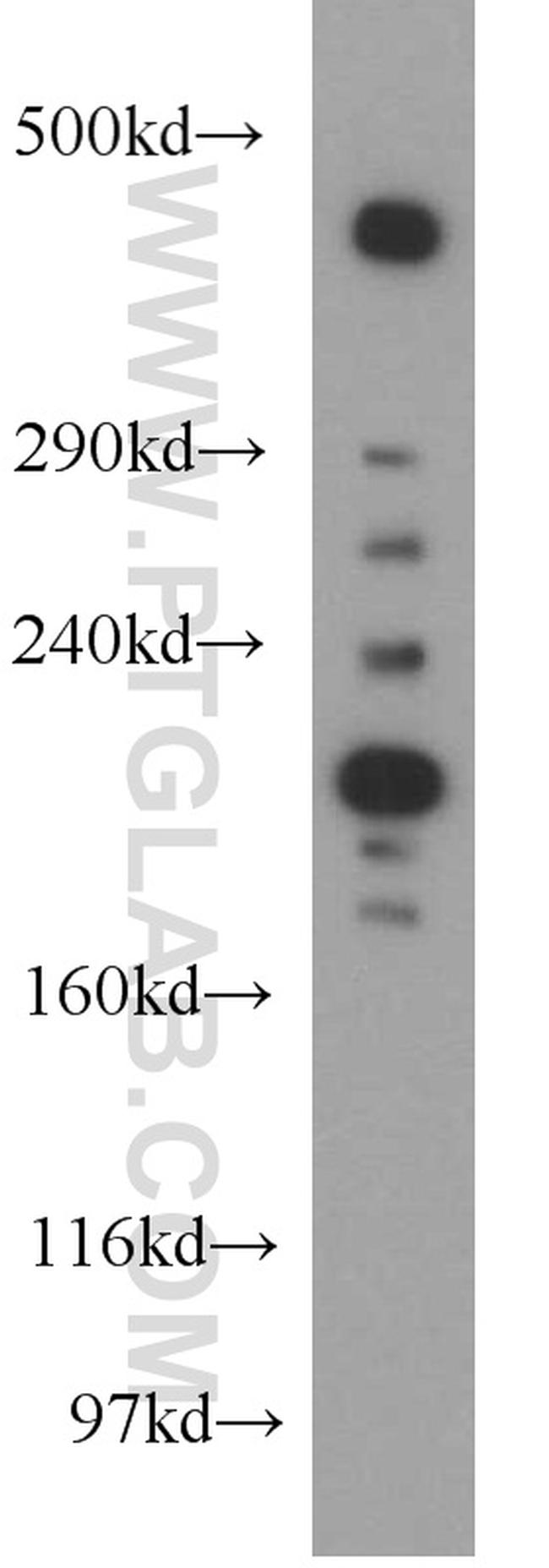 MAP1B Antibody in Western Blot (WB)