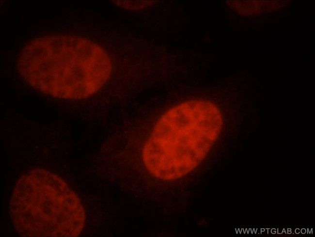 SMARCA4/BRG1 Antibody in Immunocytochemistry (ICC/IF)