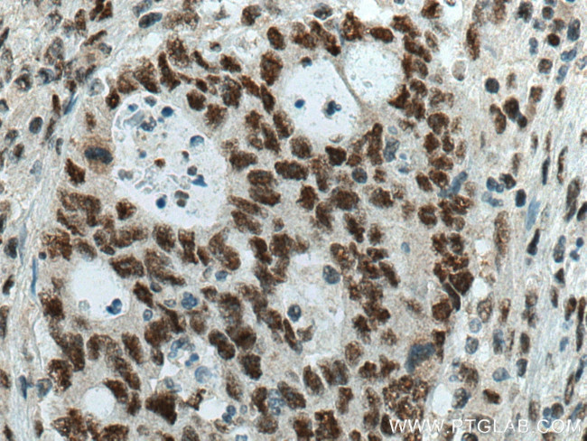 SMARCA4/BRG1 Antibody in Immunohistochemistry (Paraffin) (IHC (P))