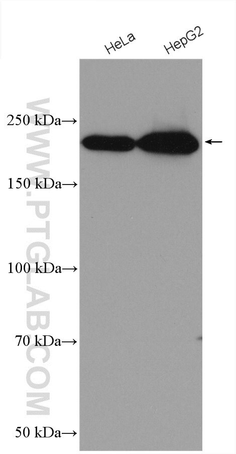 SMARCA4/BRG1 Antibody in Western Blot (WB)