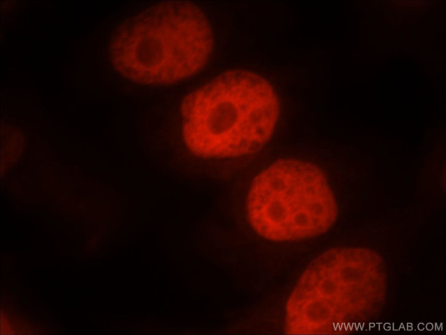 SMARCA4/BRG1 Antibody in Immunocytochemistry (ICC/IF)