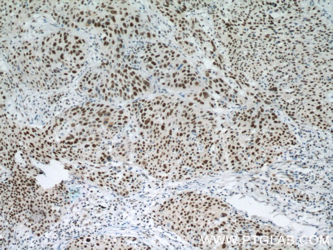 SMARCA4/BRG1 Antibody in Immunohistochemistry (Paraffin) (IHC (P))