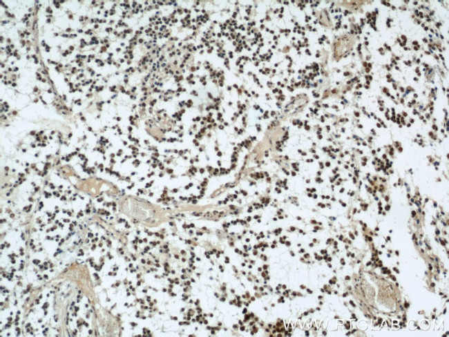 SMARCA4/BRG1 Antibody in Immunohistochemistry (Paraffin) (IHC (P))