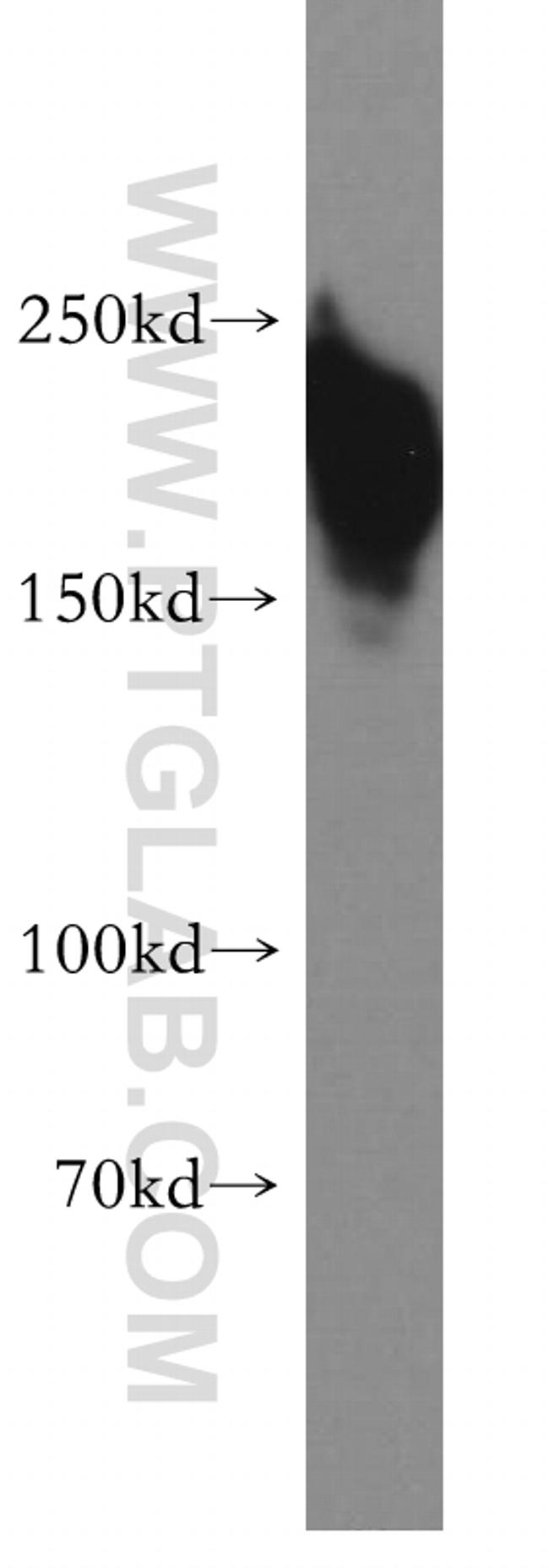 SMARCA4/BRG1 Antibody in Western Blot (WB)