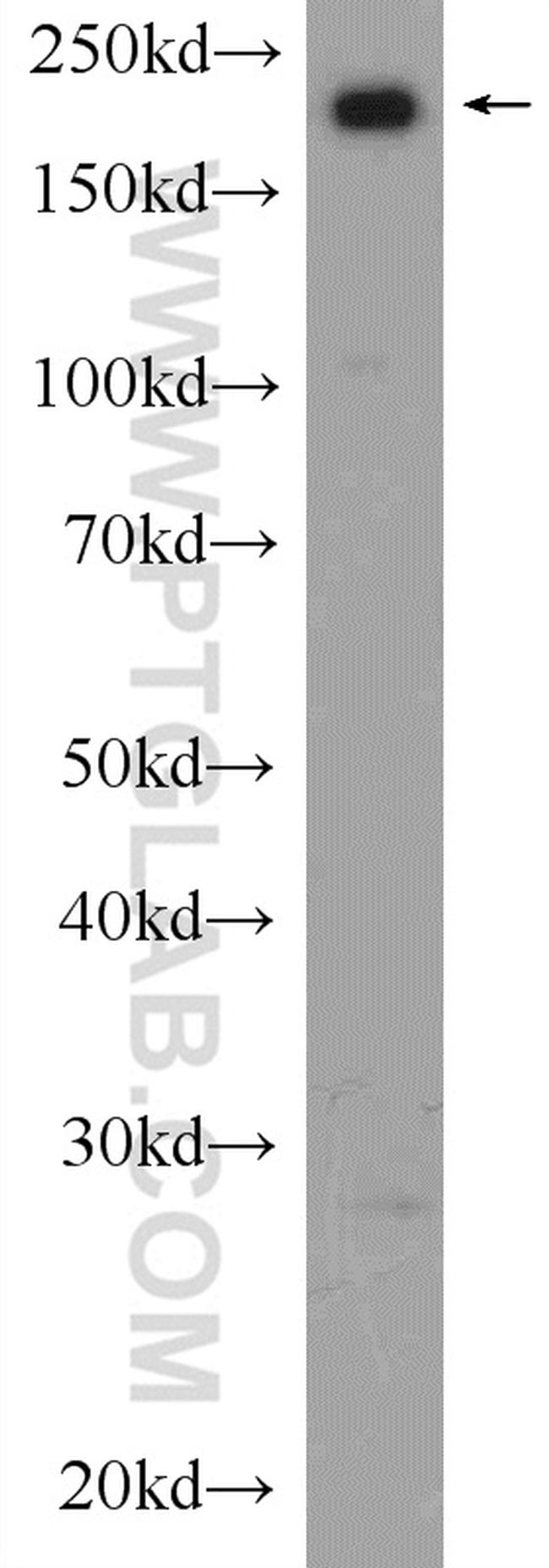 SMARCA4/BRG1 Antibody in Western Blot (WB)