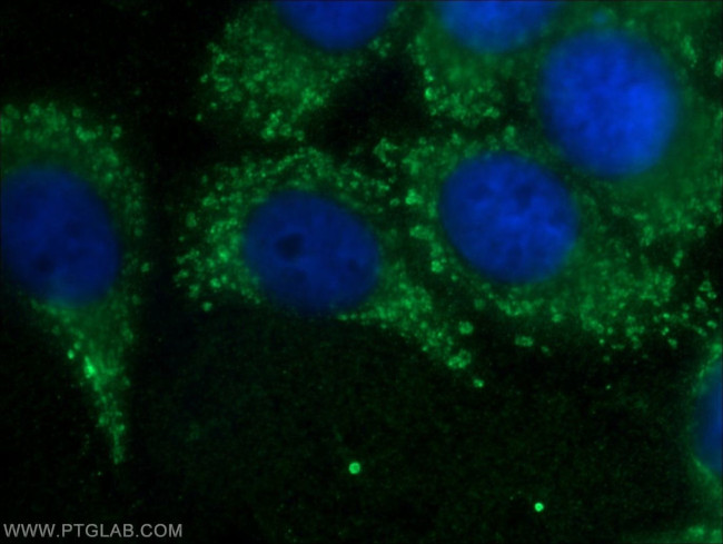 RPLP1 Antibody in Immunocytochemistry (ICC/IF)