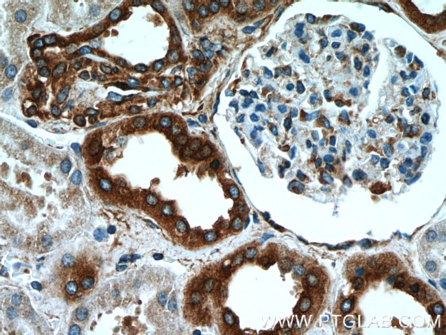 RPLP1 Antibody in Immunohistochemistry (Paraffin) (IHC (P))