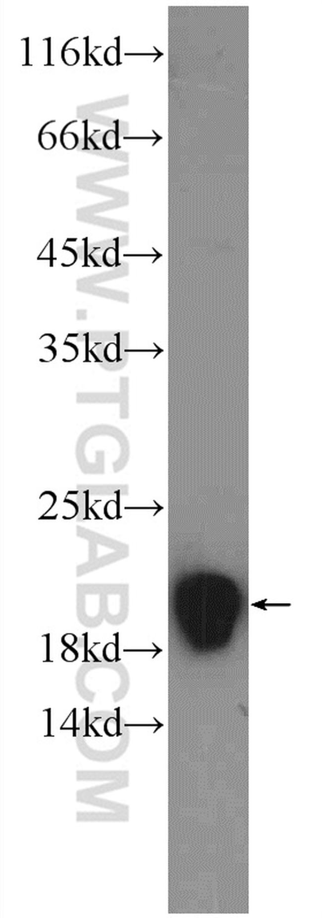 RPLP1 Antibody in Western Blot (WB)