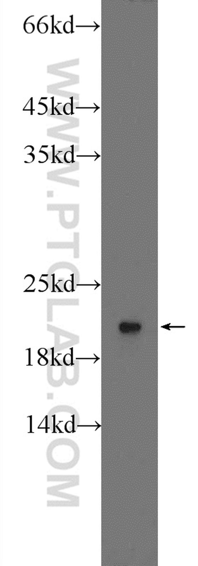 RPLP1 Antibody in Western Blot (WB)