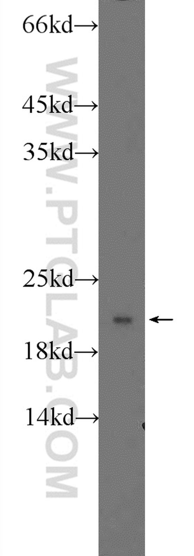 RPLP1 Antibody in Western Blot (WB)