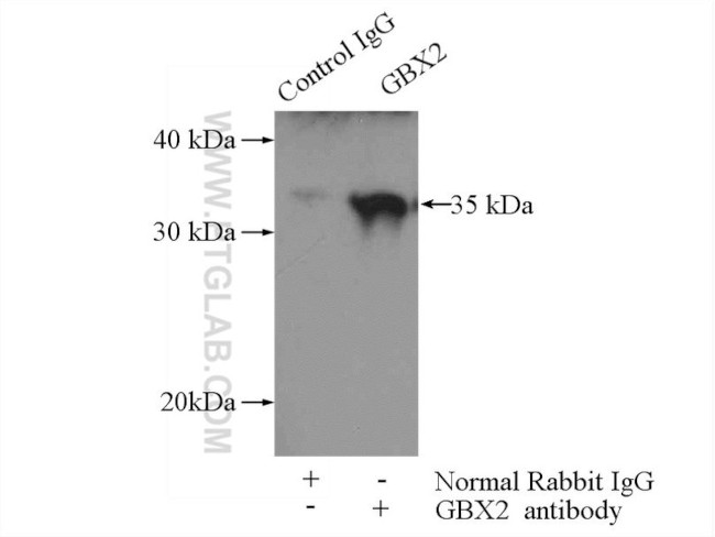 GBX2 Antibody in Immunoprecipitation (IP)