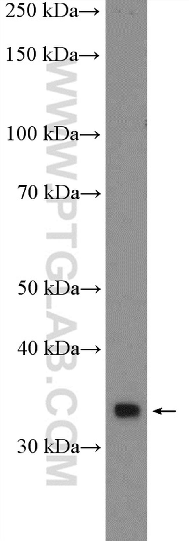 GBX2 Antibody in Western Blot (WB)