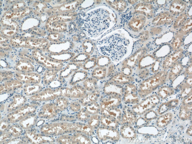 AKT3 Antibody in Immunohistochemistry (Paraffin) (IHC (P))