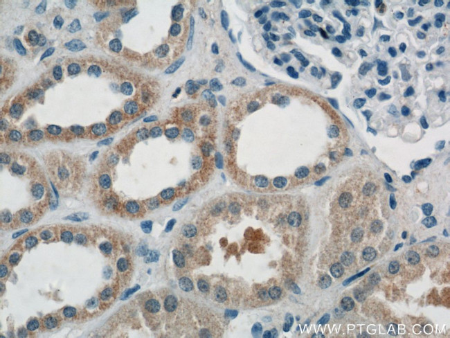 AKT3 Antibody in Immunohistochemistry (Paraffin) (IHC (P))