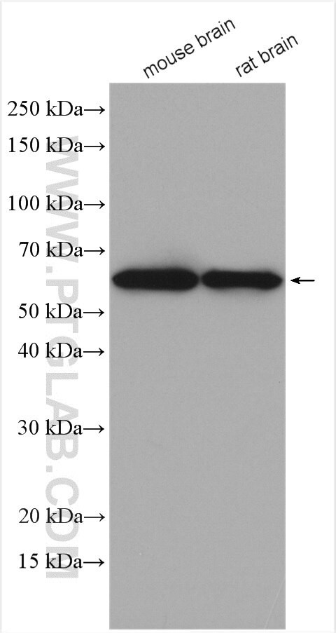 AKT3 Antibody in Western Blot (WB)