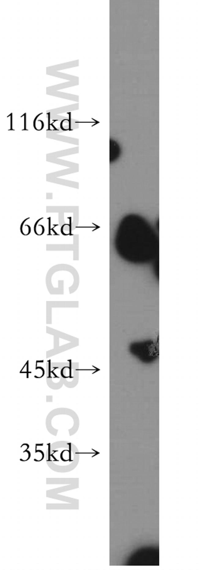 AKT3 Antibody in Western Blot (WB)