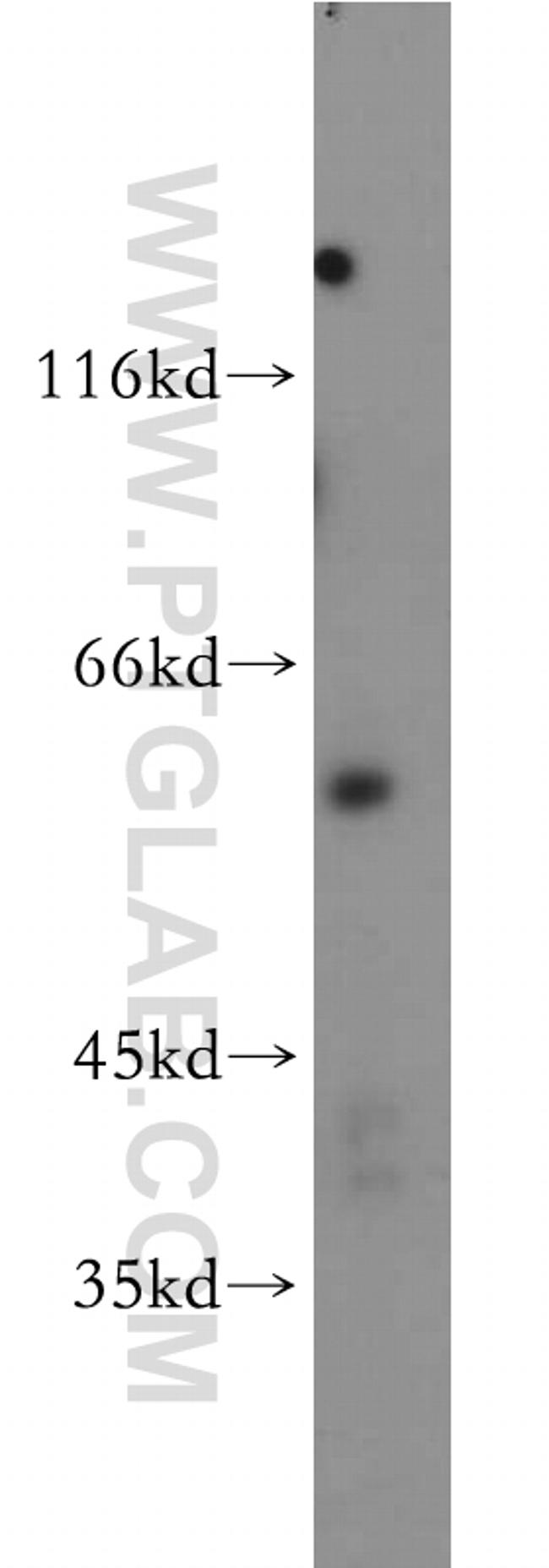 AKT3 Antibody in Western Blot (WB)