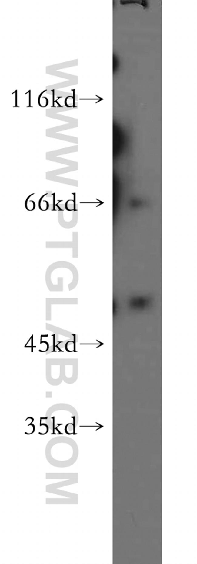 AKT3 Antibody in Western Blot (WB)