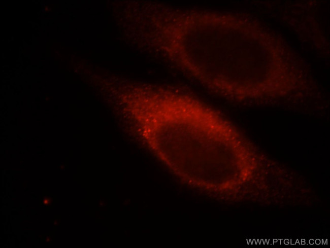 MYLK Antibody in Immunocytochemistry (ICC/IF)