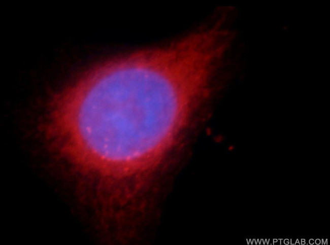 MYLK Antibody in Immunocytochemistry (ICC/IF)