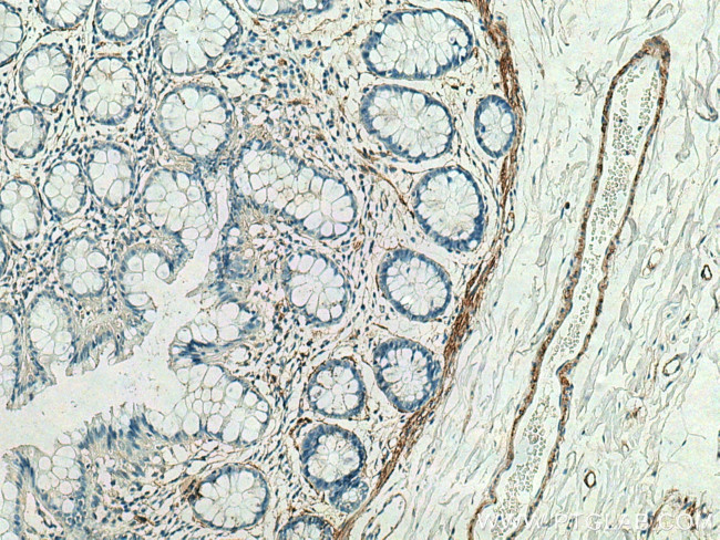 MYLK Antibody in Immunohistochemistry (Paraffin) (IHC (P))