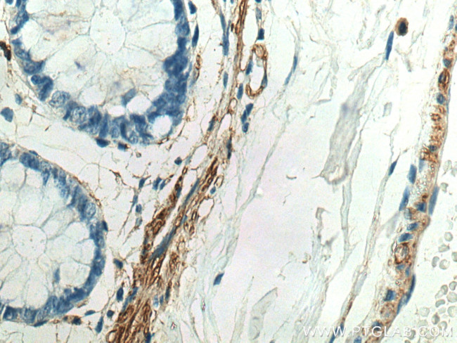 MYLK Antibody in Immunohistochemistry (Paraffin) (IHC (P))