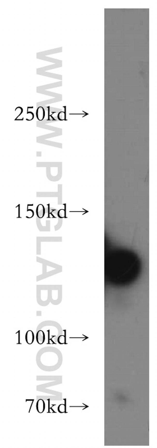 MYLK Antibody in Western Blot (WB)