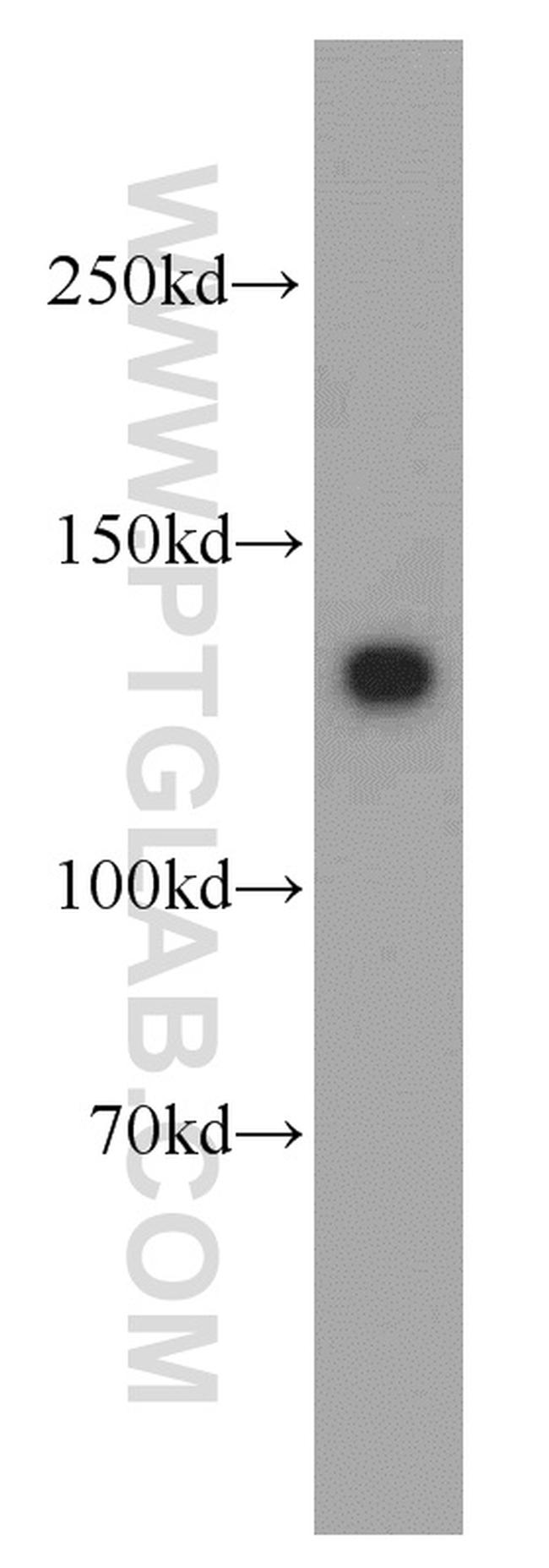 MYLK Antibody in Western Blot (WB)