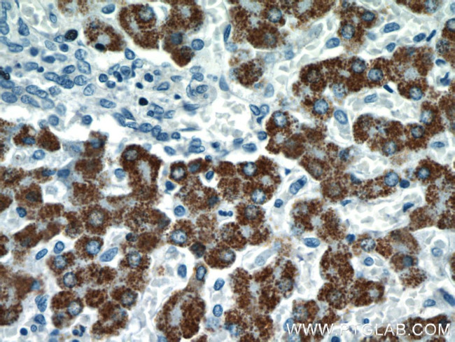 ROCK2(middle) Antibody in Immunohistochemistry (Paraffin) (IHC (P))