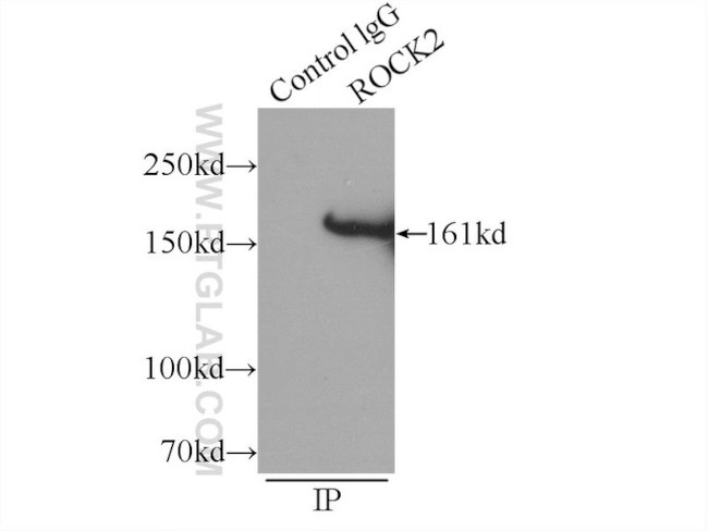 ROCK2(middle) Antibody in Immunoprecipitation (IP)