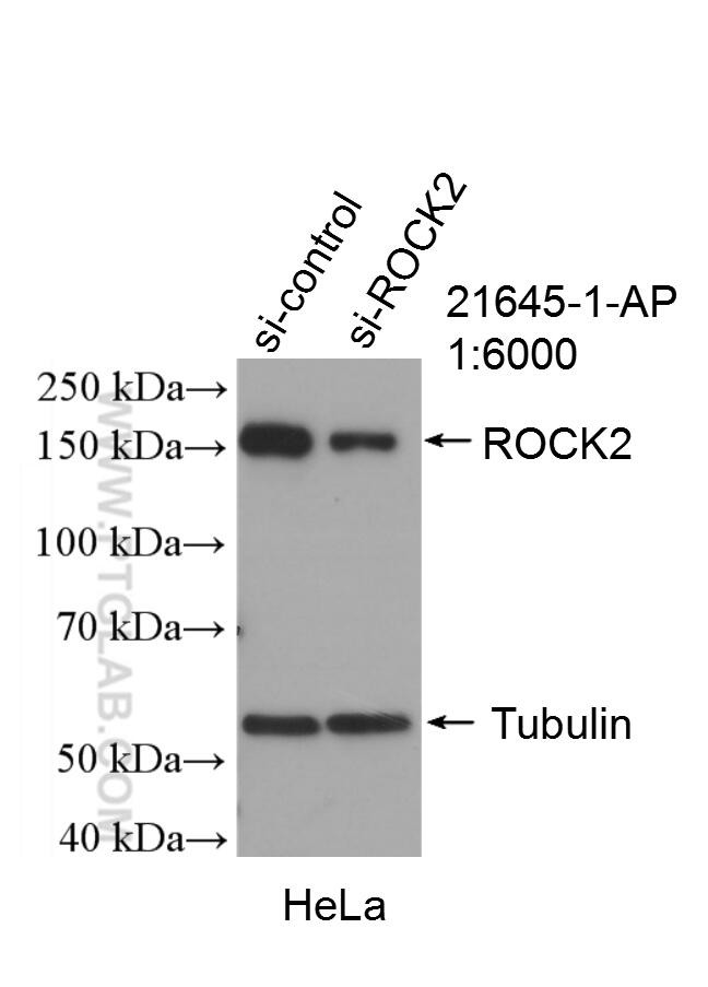 ROCK2(middle) Antibody in Western Blot (WB)