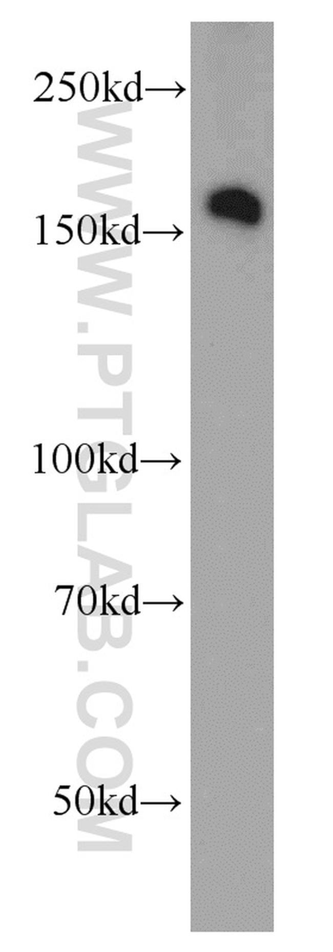 ROCK2(middle) Antibody in Western Blot (WB)