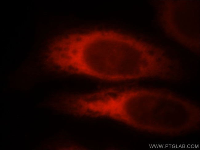 ROCK2(middle) Antibody in Immunocytochemistry (ICC/IF)